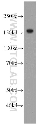 MSH6 Antibody in Western Blot (WB)
