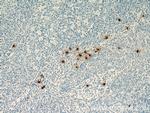 TPSAB1 Antibody in Immunohistochemistry (Paraffin) (IHC (P))