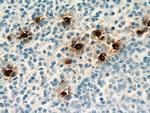 TPSAB1 Antibody in Immunohistochemistry (Paraffin) (IHC (P))