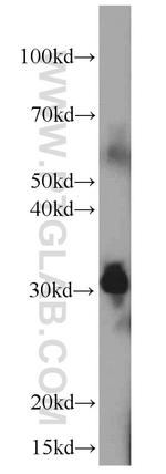 TPSAB1 Antibody in Western Blot (WB)