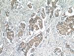 Zinc-alpha-2-glycoprotein Antibody in Immunohistochemistry (Paraffin) (IHC (P))