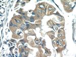 Zinc-alpha-2-glycoprotein Antibody in Immunohistochemistry (Paraffin) (IHC (P))