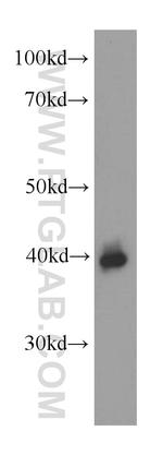 Zinc-alpha-2-glycoprotein Antibody in Western Blot (WB)