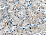 Zinc-alpha-2-glycoprotein Antibody in Immunohistochemistry (Paraffin) (IHC (P))
