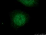 SMARCE1 Antibody in Immunocytochemistry (ICC/IF)
