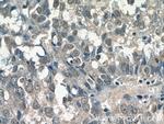 SMARCE1 Antibody in Immunohistochemistry (Paraffin) (IHC (P))