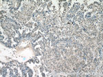 SMARCE1 Antibody in Immunohistochemistry (Paraffin) (IHC (P))