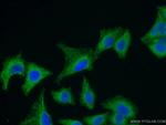 SEPT8 Antibody in Immunocytochemistry (ICC/IF)