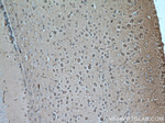 SEPT8 Antibody in Immunohistochemistry (Paraffin) (IHC (P))