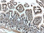 IL22RA2 Antibody in Immunohistochemistry (Paraffin) (IHC (P))