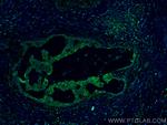 IL22RA2 Antibody in Immunohistochemistry (PFA fixed) (IHC (PFA))