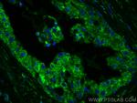 IL22RA2 Antibody in Immunohistochemistry (PFA fixed) (IHC (PFA))