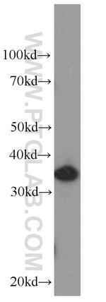 IL22RA2 Antibody in Western Blot (WB)