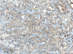 IL22RA2 Antibody in Immunohistochemistry (Paraffin) (IHC (P))