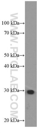 VAPB Antibody in Western Blot (WB)