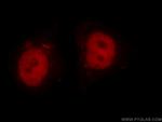 MTA2 Antibody in Immunocytochemistry (ICC/IF)