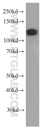 MCM2 Antibody in Western Blot (WB)