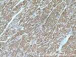 Myoglobin Antibody in Immunohistochemistry (Paraffin) (IHC (P))