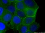 p120 Catenin Antibody in Immunocytochemistry (ICC/IF)