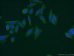 JNK Antibody in Immunocytochemistry (ICC/IF)