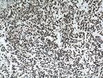 TLE1 Antibody in Immunohistochemistry (Paraffin) (IHC (P))