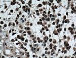 TLE1 Antibody in Immunohistochemistry (Paraffin) (IHC (P))