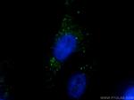 EEA1 Antibody in Immunocytochemistry (ICC/IF)