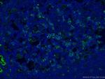 PD-1/CD279 Antibody in Immunohistochemistry (PFA fixed) (IHC (PFA))