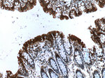 Alpha E catenin Antibody in Immunohistochemistry (Paraffin) (IHC (P))