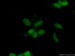CHD4 Antibody in Immunocytochemistry (ICC/IF)