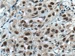 CHD4 Antibody in Immunohistochemistry (Paraffin) (IHC (P))