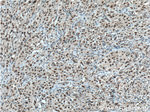 CHD4 Antibody in Immunohistochemistry (Paraffin) (IHC (P))