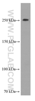 CHD4 Antibody in Western Blot (WB)