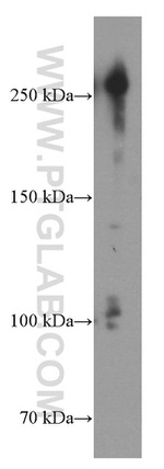 CHD4 Antibody in Western Blot (WB)