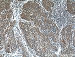 HPSE Antibody in Immunohistochemistry (Paraffin) (IHC (P))