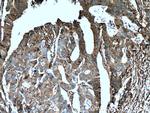 S100A10 Antibody in Immunohistochemistry (Paraffin) (IHC (P))