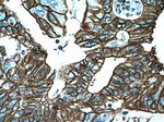 S100A10 Antibody in Immunohistochemistry (Paraffin) (IHC (P))
