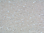 UCHL1 Antibody in Immunohistochemistry (Paraffin) (IHC (P))