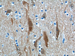 UCHL1 Antibody in Immunohistochemistry (Paraffin) (IHC (P))