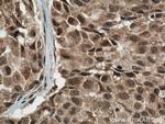 p38 MAPK Antibody in Immunohistochemistry (Paraffin) (IHC (P))