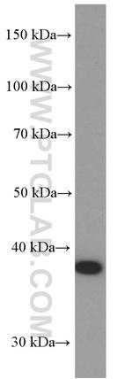 p38 MAPK Antibody in Western Blot (WB)