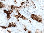 Mammaglobin A Antibody in Immunohistochemistry (Paraffin) (IHC (P))