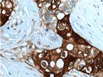 Mammaglobin A Antibody in Immunohistochemistry (Paraffin) (IHC (P))