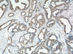 Mammaglobin A Antibody in Immunohistochemistry (Paraffin) (IHC (P))