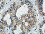 Mammaglobin A Antibody in Immunohistochemistry (Paraffin) (IHC (P))
