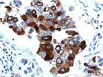 Mammaglobin A Antibody in Immunohistochemistry (Paraffin) (IHC (P))