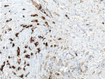 Mammaglobin A Antibody in Immunohistochemistry (Paraffin) (IHC (P))
