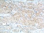 STXBP2 Antibody in Immunohistochemistry (Paraffin) (IHC (P))