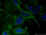 ADIPOQ Antibody in Immunocytochemistry (ICC/IF)