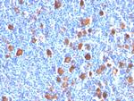 Fascin-1 (Reed-Sternberg Cell Marker) Antibody in Immunohistochemistry (Paraffin) (IHC (P))